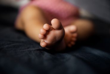 20 February 2025 - Safeguarding: Bruising in Non-Mobile Infants - Accidental, Medical or Non-Accidental